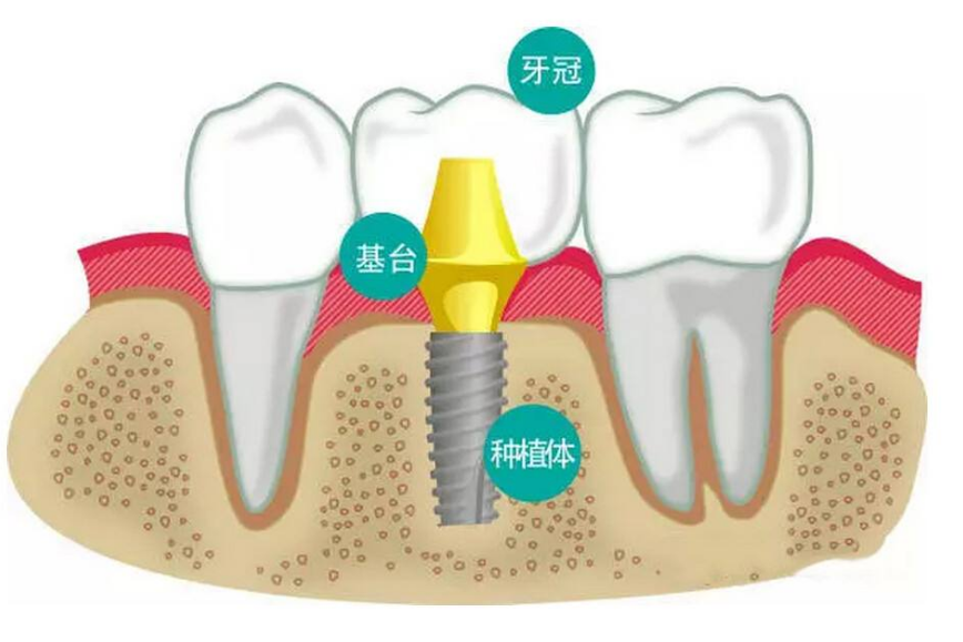 最新牙手艺重塑口腔康健未来